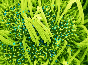 Human bronchial cells (green) infected with SARS-CoV-2 (blue) - Institut Pasteur