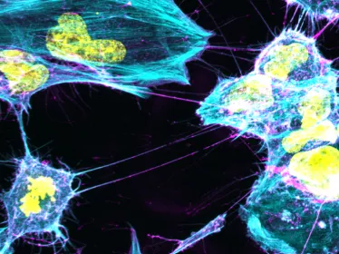 Les cellules microgliales humaines se connectent entre elles par l'intermédiaire de TNT. L'élément du cytosquelette, l'actine, est marqué en cyan, la membrane plasmique en magenta et les noyaux en jaune. © Institut Pasteur/Ranabir Ranabir CHAKRABORTY et C