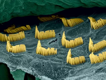 Cellules sensorielles auditives de l'oreille interne © Institut Pasteur