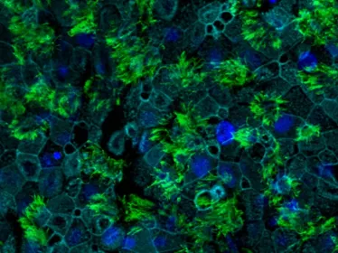 Nouvelle découverte sur les récepteurs d’entrée des coronavirus dans les cellules humaines 