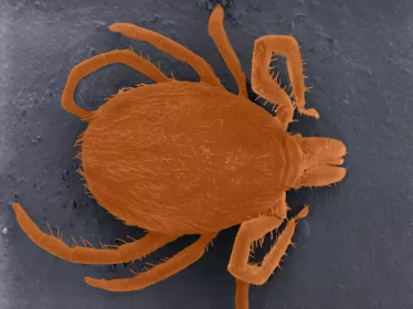 Ixodes ricinus