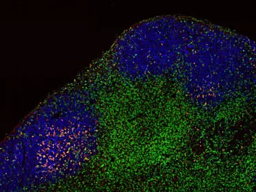 Anticorps anti-PD-1 - cellules T - ganglions lymphatiques - Institut Pasteur