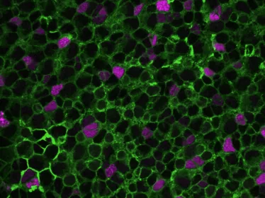 Cellules souches neurales © Institut Pasteur/Nicolas Dray, Laure Mancini, Laure Bally-Cuif