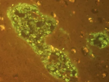 Cryptococcus neoformans dans un abcès du cerveau © Institut Pasteur/Françoise Dromer