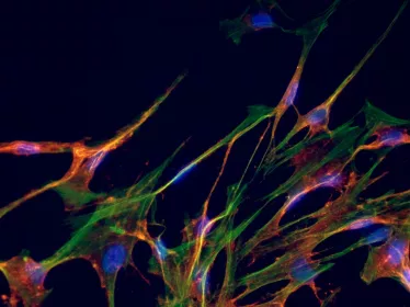 Détection du virus Chikungunya © Institut Pasteur/Thérèse Couderc et Marc Lecuit 
