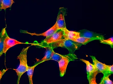 Détection du virus Chikungunya dans des cellules Véro en culture en microscopie à fluorescence - Institut Pasteur