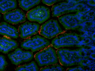Cellules de l'intestin grêle murin et bactéries