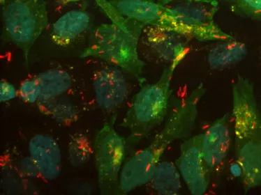 shigella copyright Institut Pasteur