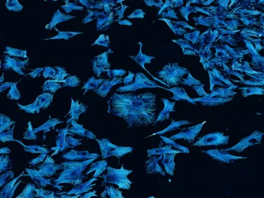 Cellules de glioblastome humain © Institut Pasteur