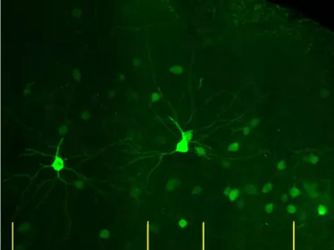 mouse frontal cortex copyright Institut Pasteur