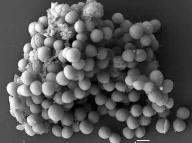 staphylococcus_aureus copyright Institut Pasteur
