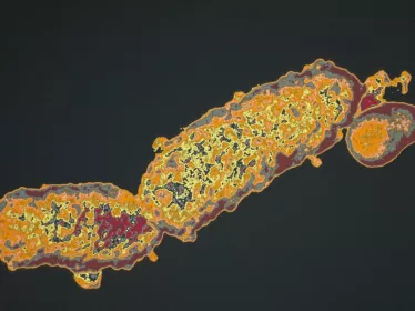 bactérie Bordetella pertussis