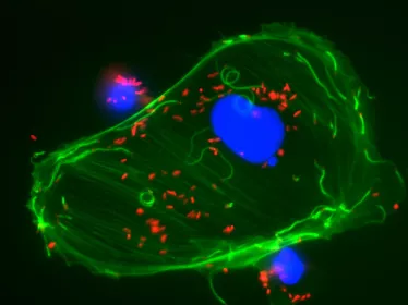 Observation en microscopie à fluorescence d'une cellules infectée par Listeria ©  Institut Pasteur/Edith Gouin et Pascale Cossart