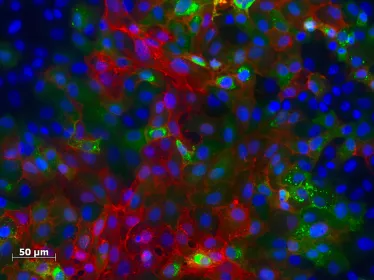 Infection de cellules humaines par un virus Chikungunya fluorescent (rouge et vert).
