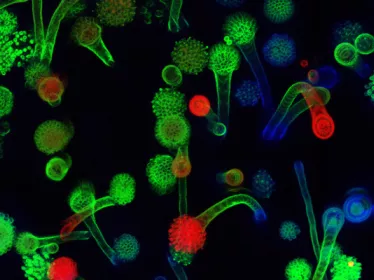 Photo de microscopie - Têtes aspergillaires d'Aspergillus fumigatus en milieu aérien.