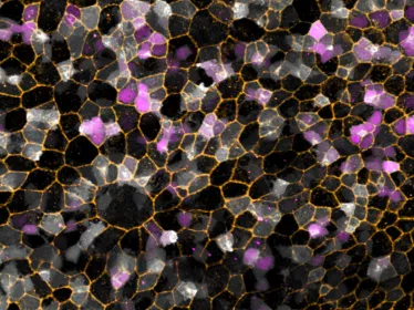 Photo de microscopie, illustration