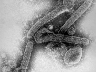 Image de microscopie électronique à transmission révélant une partie de la morphologie ultrastructurale présentée par un certain nombre de virions du virus Marburg