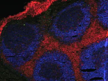 Plaques de Peyer vues du dessus. Il s'agit d'une population de lymphocytes qui "veillent "sur l'intestin