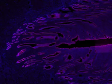 Image en immunofluorescence d'une coupe d'endomètre marquant les cellules épithéliales (magenta) et les noyaux des cellules (bleu).