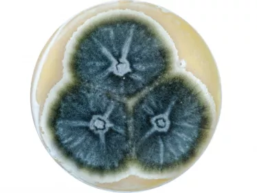 aspergillose