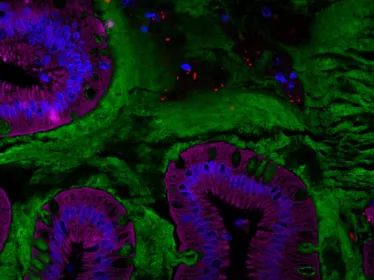 Coupe d’intestin humain représentant le microbiote intestinal