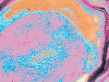 Sporulation atypique de Clostridium perfringens