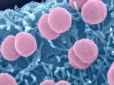 Bactéries Neisseria meningitidis adhérant à la surface de cellules épithéliales - Institut Pasteur