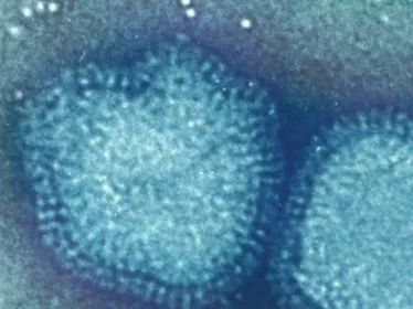 Virus de la grippe type A - Institut Pasteur