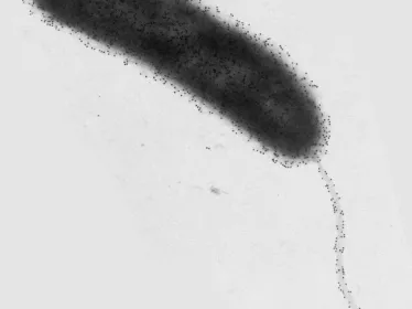 Vue en microscopie électronique d'un vibrion cholérique - Institut Pasteur