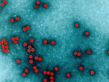 Photographie de microscopie colorisée d'un poliovirus