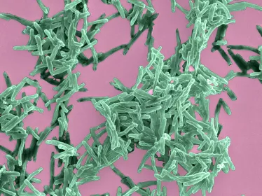 Mycobacterium tuberculosis, agent de la tuberculose. Microscopie electronique à balayage colorisée.