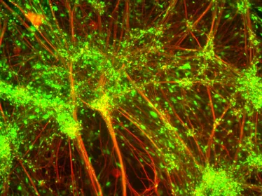 Neurones infectés avec le virus de la rage