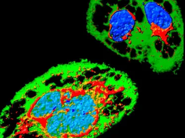 Cellule infectée par Zika