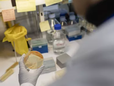 Reportage dans l’unité Biologie évolutive de la cellule microbienne. - Report from the Evolutionary Biology of Microbial Cells Unit.