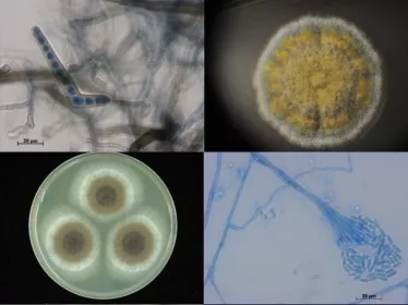 Medical Mycology