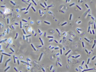 observation au microscope d’une culture de Clostridium botulinum à l’état frais (grossissement x1000).