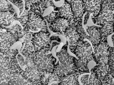 Cellules ciliées dans le noeud d'une souris mutante, vues par microscopie électronique à balayage. Ce modèle avec des cils paralysés permet de mieux comprendre comment le cœur se forme et reconnaît la droite et la gauche.
