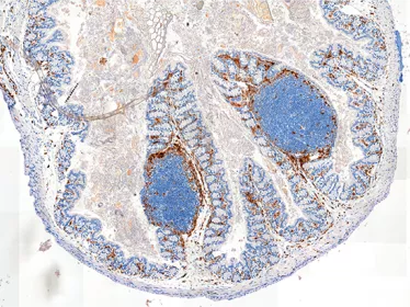 Gut microbes help set the body’s response to vaccination 
