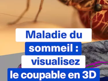 Maladie du sommeil