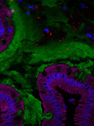 Coupe d’intestin humain représentant le microbiote intestinal
