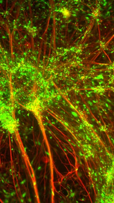 Neurones infectés avec le virus de la rage