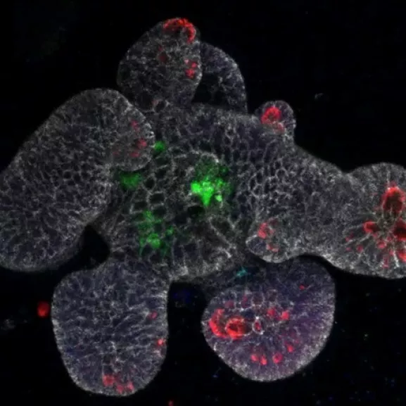 Goblet cell Listeria - Institut Pasteur