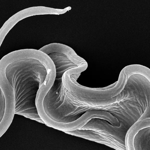 Forme sanguine de Trypanosoma brucei