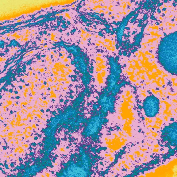 Santé Publique - CCOMS - Surveillance des résistances aux molécules antipaludiques - Institut Pasteur