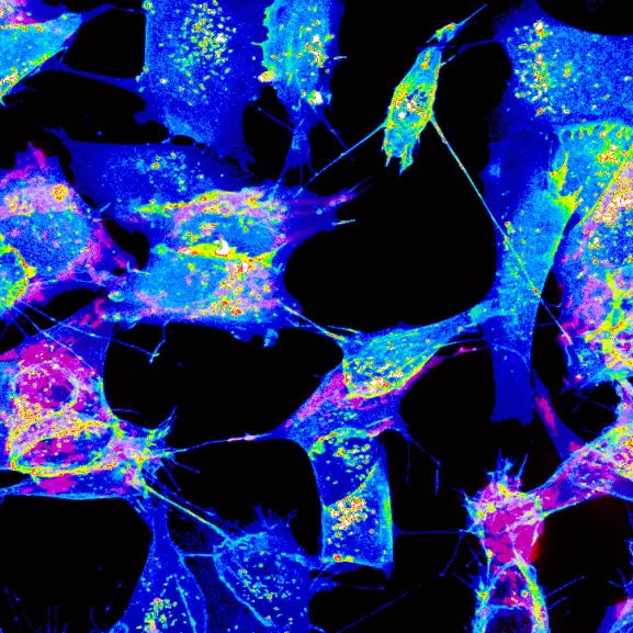 Plusieurs cellules connectées par des nanotubes