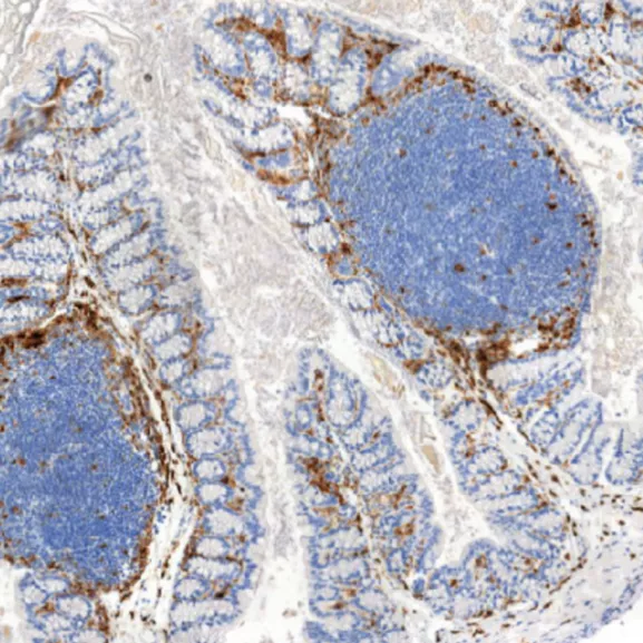 Coupe de tissu intestinal avec un marquage des cellules immunitaires