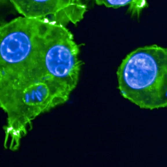 Macrophages infectés avec Yersinia pestis.