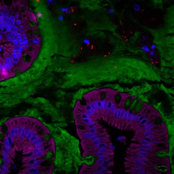 Coupe d’intestin humain représentant le microbiote intestinal