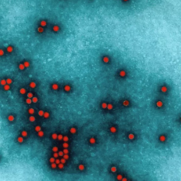 Entérovirus et Vaccins viraux - Institut Pasteur