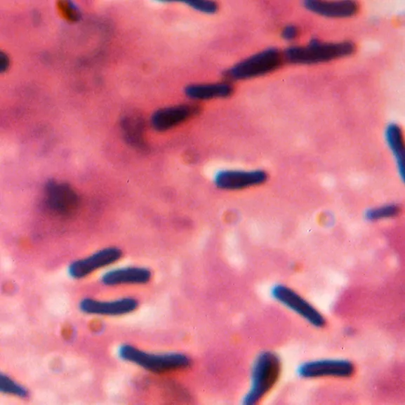Corynebacterium diphteriae (ou bacille de Klebs et Loeffler)